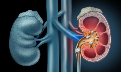 kidney-functions